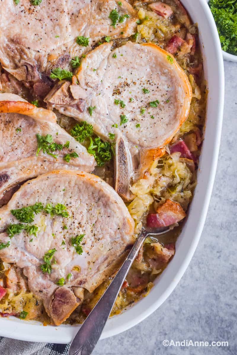 Close up of pork chops with sauerkraut and bacon in white casserole dish.
